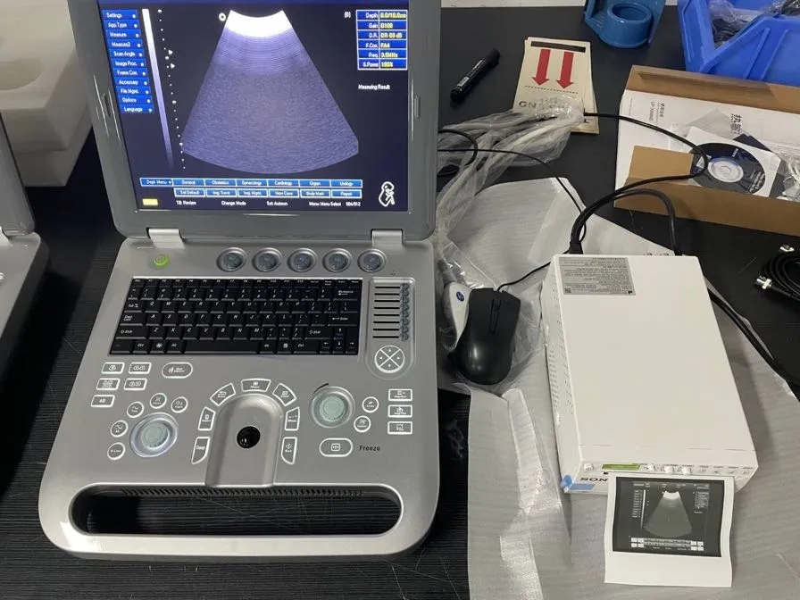 Цветной допплеровскийузи аппарат Sun-906B