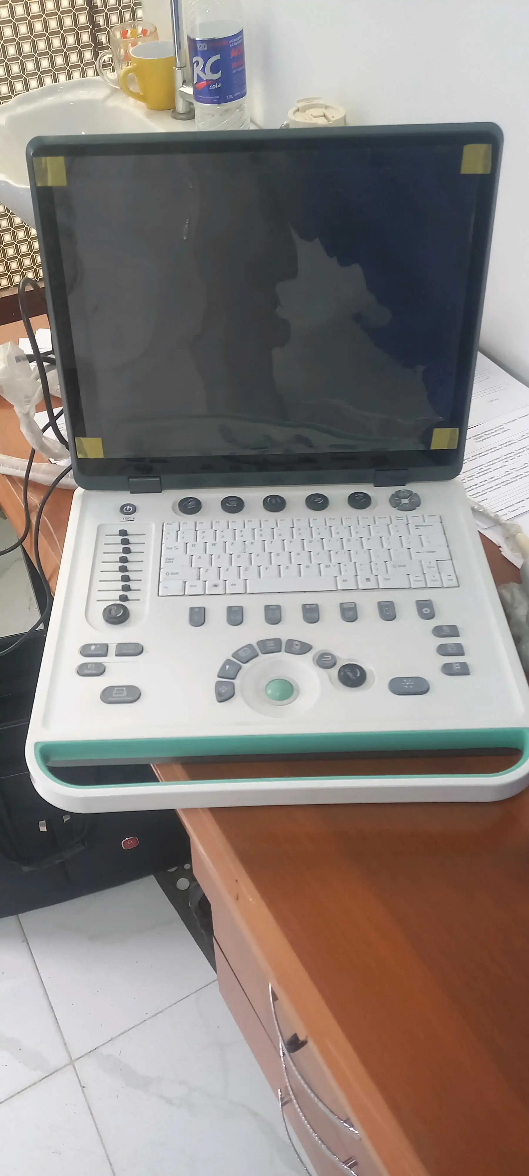 УЗИ портативний соностар ss-9