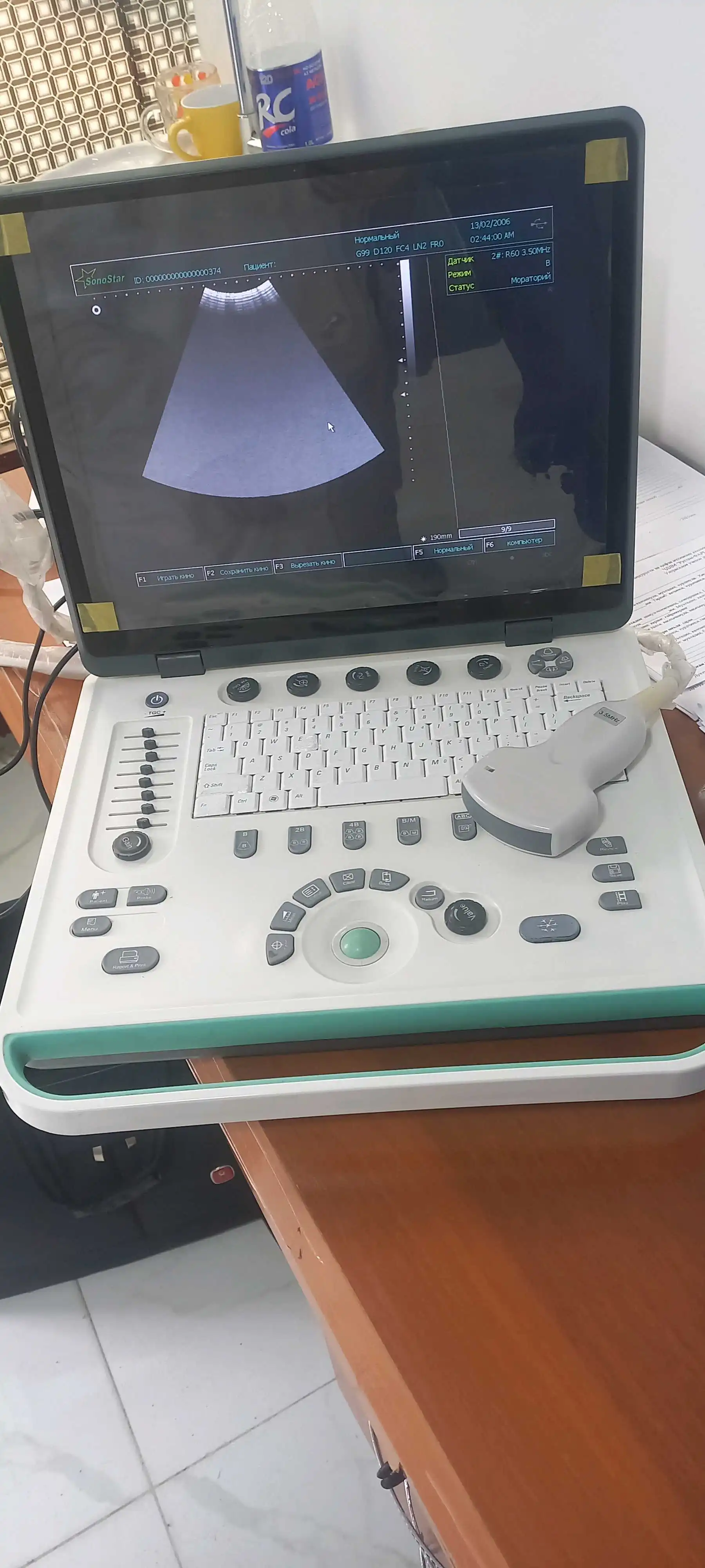 УЗИ портативний соностар ss-9