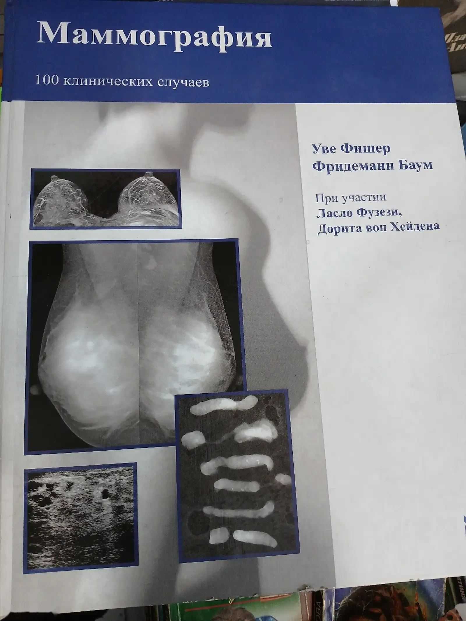 Книга Маммография