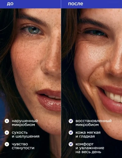 Тоник барои пусти руй — миниатюра 3