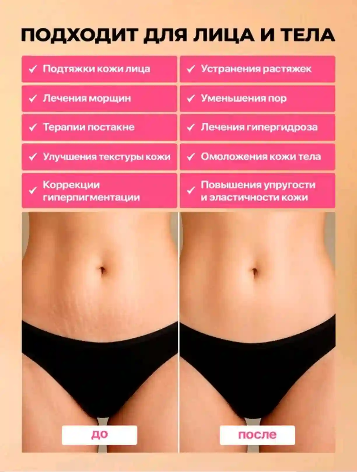 Ladiesparadise RF-лифтинг Аппарат РФ Лифтинг А2