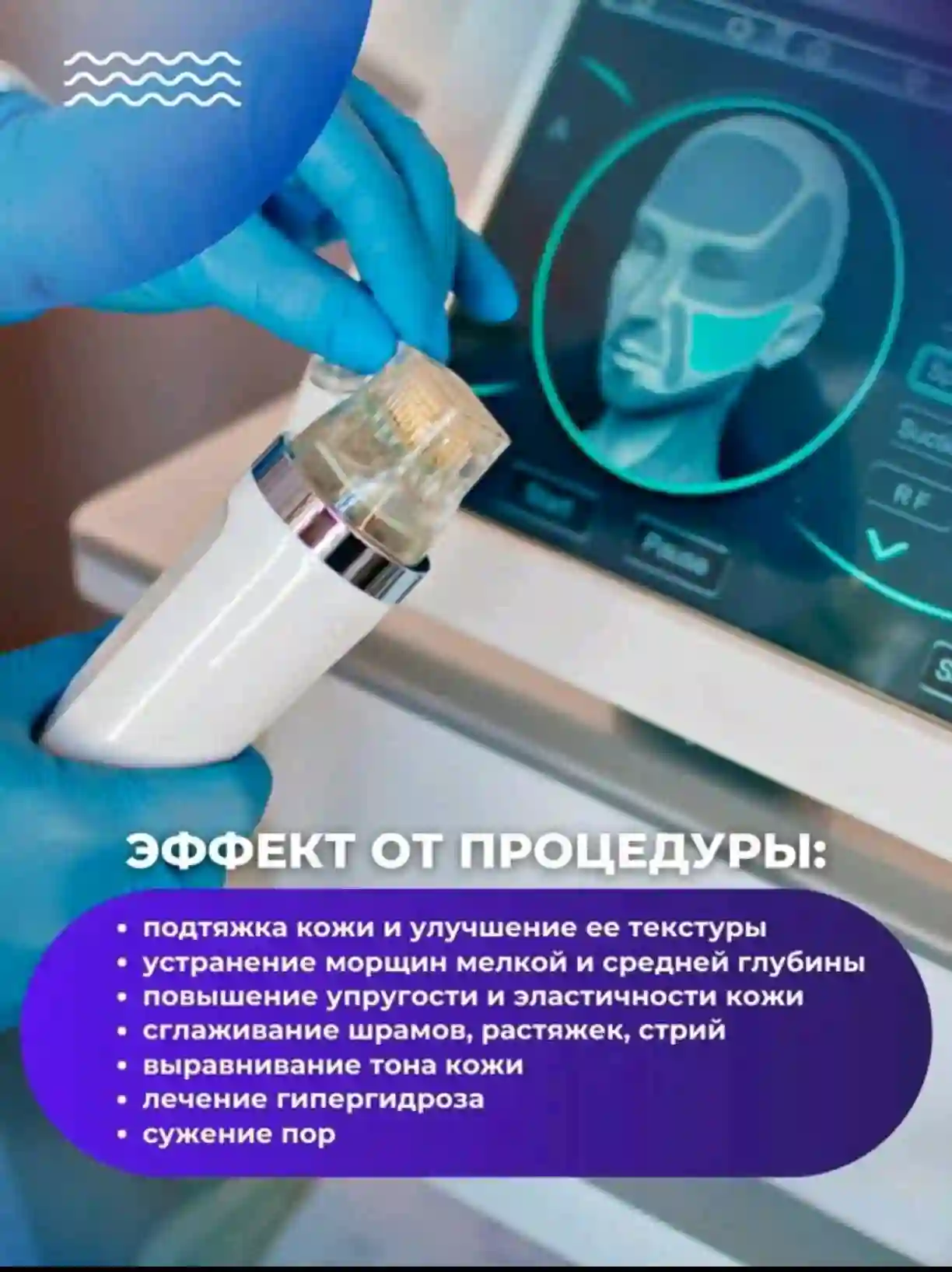 Ladiesparadise RF-лифтинг Аппарат РФ Лифтинг А2
