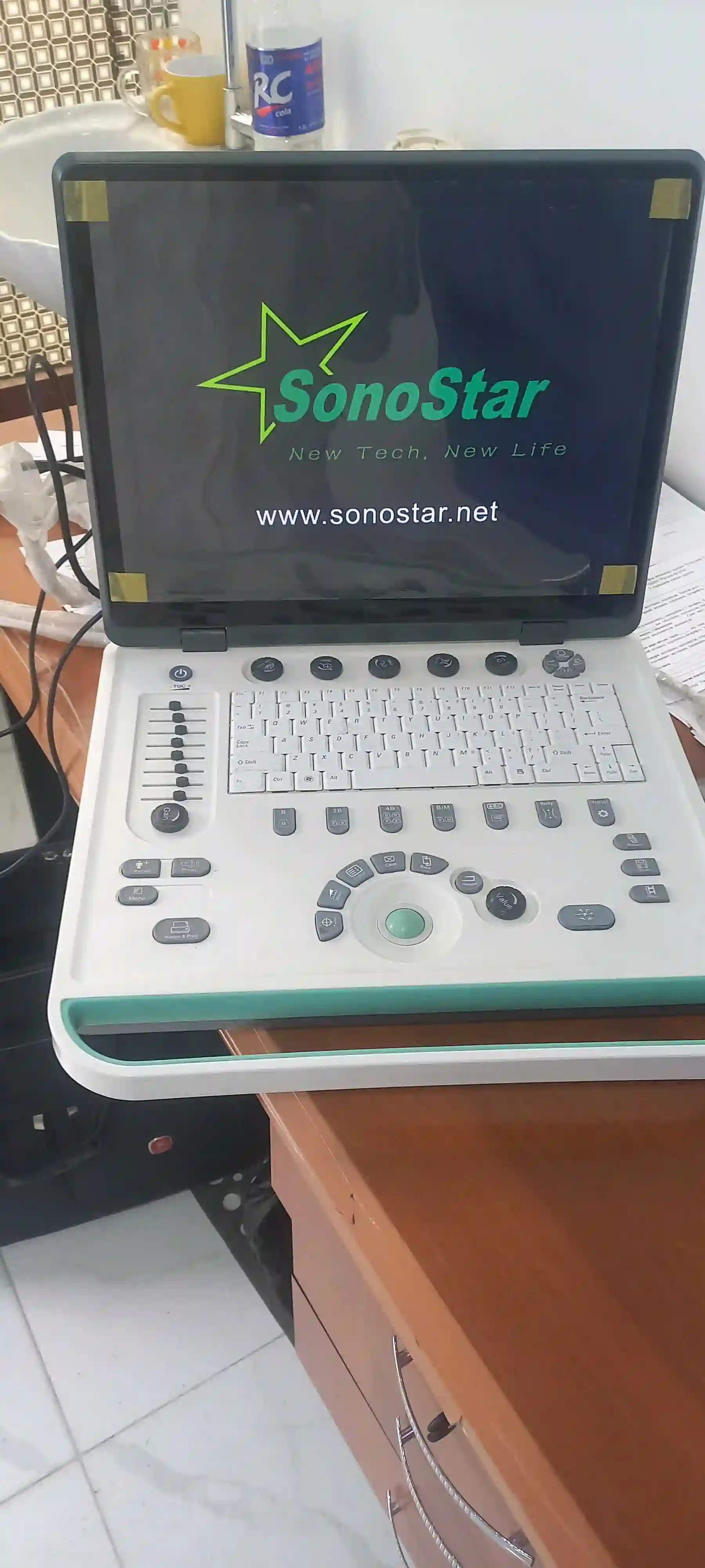 УЗИ портативний соностар ss-9 