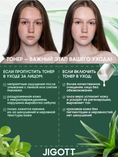 Тонер барои руй аз алоэ — миниатюра 4
