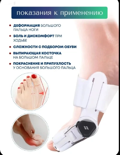 Вальгусная шарнирная шина MyBalance с регулировкой, бандаж от вальгуса, цвет бел — миниатюра 3
