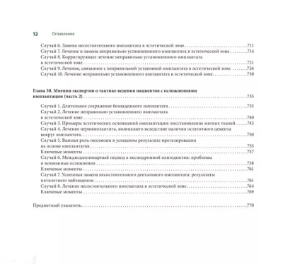 Книга Осложнения дентальной имплантации на заказ — миниатюра 4